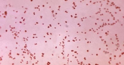 Imagen microsc&oacute;pica de bacterias de gonococo.