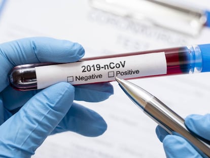 Autónomo y coronavirus. Un problema para su salud. Y para su bolsillo