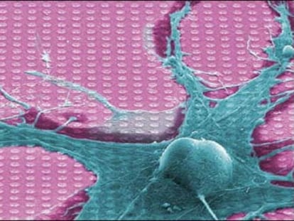 Imagen de un neurochip distribuida por la empresa alemana de nuevas tecnologías Infineon.