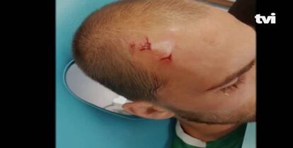 Bas Dost, herido, en el vestuario.