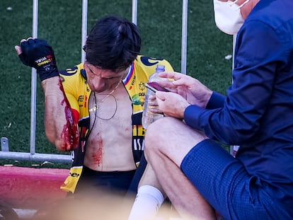 Roglic, en la meta de Tomares, después de la caída en el esprint.