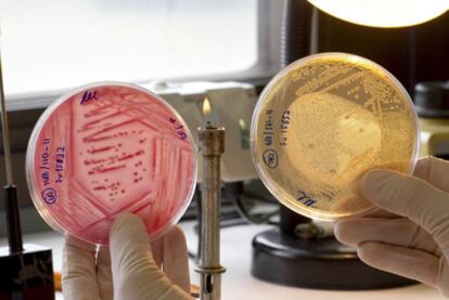 Una investigadora del Laboratorio de Lugo trabaja con muestras de placas Petri, sembradas con la bacteria 'E. Coli'.