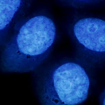 Las células tumorales con nanopartículas sometidas a un tratamiento con un campo magnético alterno mueren.