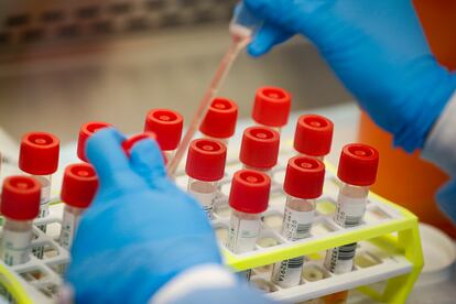 In this Wednesday, March 11, 2020 file photo, a technician prepares COVID-19 coronavirus patient samples for testing at a laboratory in New York's Long Island.