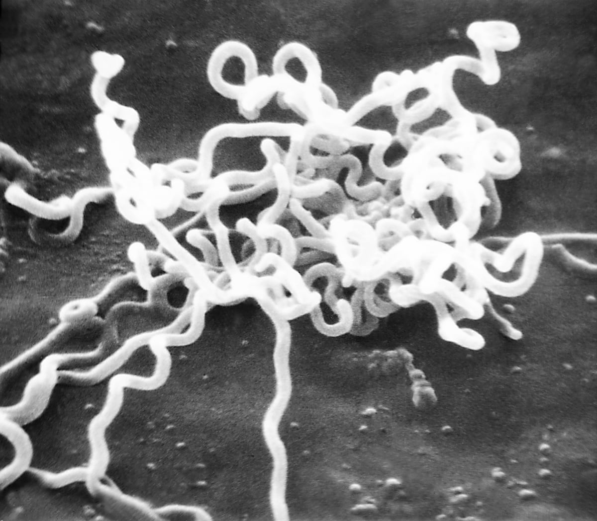 梅毒の原因となる細菌は、5,500 年前にすでにアメリカに存在していました。科学