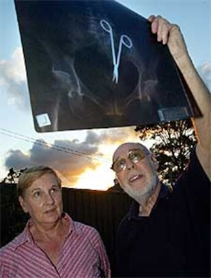 Pat Skinner, junto a su marido Don, contempla la radiografía en la que se ven las tijeras dentro de su abdomen.