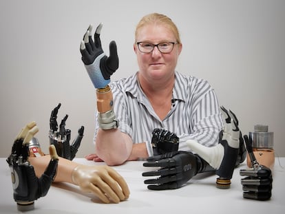 Karin con una mano biónica altamente integrada, entre otras manos biónicas, en el Centro de Investigación en Biónica y Dolor, en Gotemburgo, Suecia.