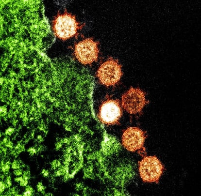 En 2003, apareció en Hong Kong un coronavirus que se extendió a dos docenas de países. El virus, cuyas partículas se pueden ver en la imagen cerca de la periferia de una célula infectada, provocaba el SARS (Síndrome Respiratorio Agudo Grave). Este coronavirus solo infectó a 8.098 personas de los que murieron 774, según datos de la Organización Mundial de la salud. Los síntomas son fiebre alta, dolor de cabeza e incomodidad en todo el cuerpo.