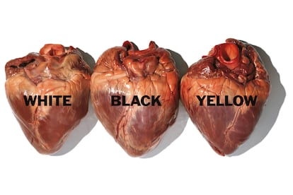 Fotografía de Oliviero Toscani para la campaña de Benetton de 1996. 