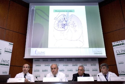 Los doctores Laureano Molins, Josep Brugada, Avelino Barros y Ruperto Olivero, en la rueda de prensa tras la intervención del Rey.