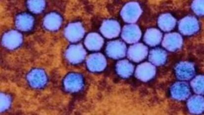Imatge microscòpica de l'enterovirus.