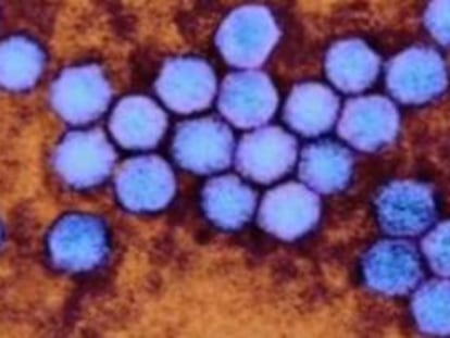 Imatge microscòpica de l'enterovirus.