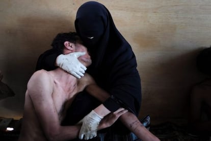 The photograph of a wounded man being held by a family member in Sana, Yemen. 