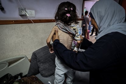 Una niña con malnutrición en el hospital de Al-Aqsa, en Gaza.