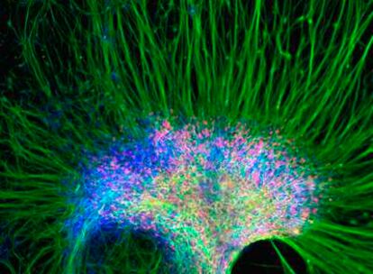 Células del sistema nervioso obtenidas en 2004 a partir de células madre embrionarias.