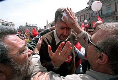 Fidalgo, tras ser golpeado durante la manifestación de hoy en Madrid.