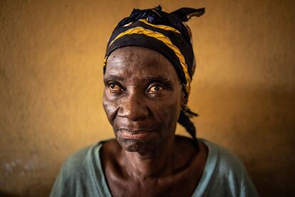 Siempre en sandalias y con un pañuelo en la cabeza, Theresa Partie pasa los días caminando encorvada por el 'slum' más grande de Monrovia. Sin familia, a sus 76 años dormía en el porche de una casa hasta que el sol comenzaba a asomar. Perdió la suya hace algo más de un año. El pasado noviembre, alquiló una reducida habitación que comparte con otra persona.
<p>“Si tengo suerte, me dan entre 100 y 200 LRD (entre 0,50 y un euro) al día”.</p>
