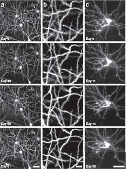 Imágenes de neuronas del hipocampo de ratón en días y escalas diferentes. La columna<b> b</b> es la ampliación de una zona de la columna <b>a</b>. La columna <b>d </b>son imágenes de dendritas.