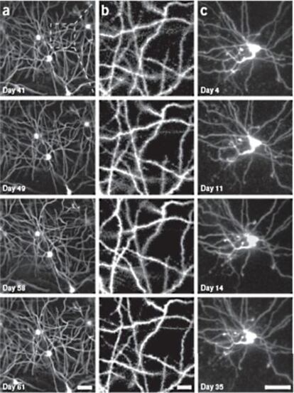 Imágenes de neuronas del hipocampo de ratón en días y escalas diferentes. La columna<b> b</b> es la ampliación de una zona de la columna <b>a</b>. La columna <b>d </b>son imágenes de dendritas.