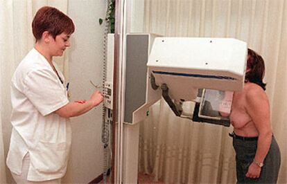Una mujer se somete a una mamografía en la sede de la Asociación Española contra el Cáncer.