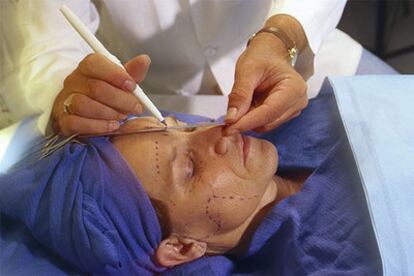 Preparativos para intervenir en la cara de una paciente.