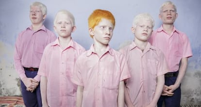 Niños albinos ciegos en India, retratados en septiembre de 2013 para Getty Images.