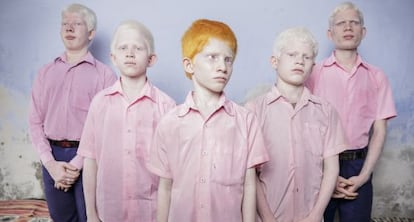 Ni&ntilde;os albinos ciegos en India, retratados en septiembre de 2013 para Getty Images.