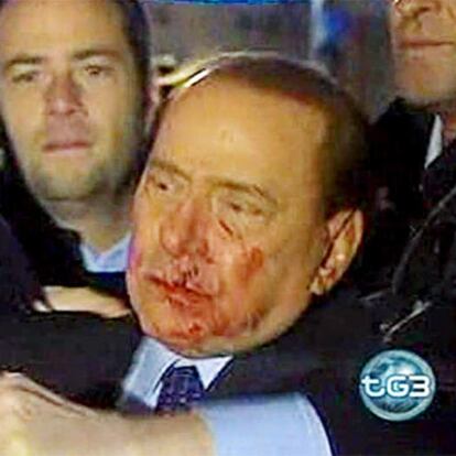 Captura de imagen sacada de la televisión Raitre en la que se ve al primer ministro italiano, Silvio Berlusconi, sangrando tras recibir una agresión a la salida de un mitin celebrado en Milán.
