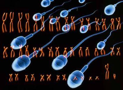 Fotomontaje de espermatozoides en movimiento sobre un cariotipo con los 46 cromosomas de un varón.