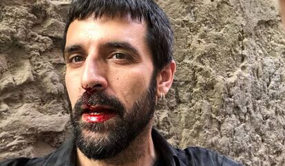 El fotoperiodista Jordi Borràs, després de l'agressió.