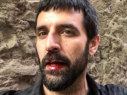 El fotoperiodista Jordi Borràs, després de l'agressió.