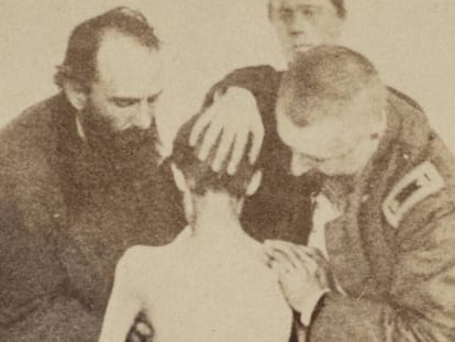 Un soldado de la Unión, tras ser liberado de una prisión confederada. 