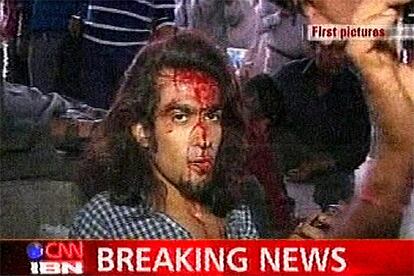 Las explosiones se produjeron entre las 18.20 y las 18.50 hora local (14.50 y 15.20 en Madrid) en vagones de primera clase de trenes suburbanos y estaciones de la línea oeste de Bombay. En una declaración leída por el titular de Interior, el primer ministro, Manmohan Singh, ha dicho que estas explosiones son "unos actos cobardes" y "un intento de hacer cundir el miedo entre los ciudadanos". En la foto, tomada de la cadena de televisión CNN, uno de los heridos.