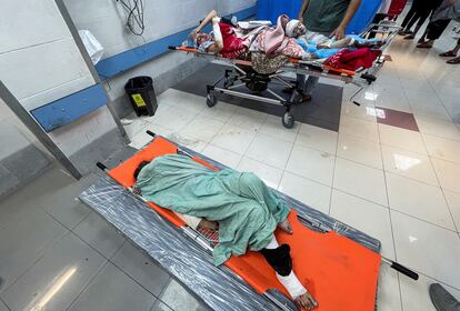 Palestinos heridos por un ataque israelí esperan a ser atendido en el hospital Shifa de Gaza, este domingo. 
