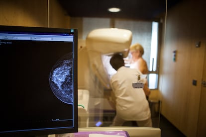 Un técnico realiza una mamografía a una mujer en un hospital francés.