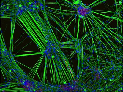 Cultivo de neuronas en una imagen de la Universidad de Oxford.