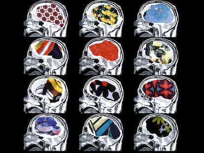 Neuro moda, la estética del cerebro