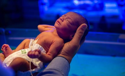 Un médico y una enfermera supervisan el estado de salud de este recién nacido con desnutrió aguda en el hospital de Prabhawati, en India. 