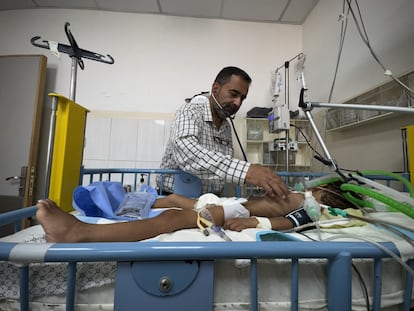 Un niño palestino que sufre de desnutrición, recibe cuidados en el Hospital Nasser de Jan Yunis, este jueves.
