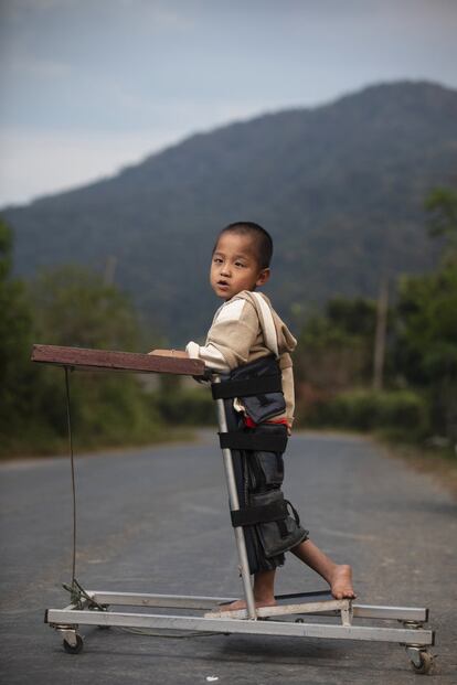 Con ayuda médica, la familia de Kum le ha diseñado un carrito artesanal con el que el pequeño puede avanzar erguido.