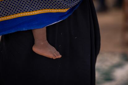 En la región etíope de Somali, Unicef está trabajando en estrecha colaboración con la oficina regional de salud. Los Equipos Móviles de Salud y Nutrición (MHNT, por sus siglas en inglés) están desplegados en las profundidades de las aldeas. Los niños con desnutrición aguda reciben un tratamiento que les salva la vida. Además, la educación y promoción de la salud, así como la vacunación de niños y mujeres embarazadas, también forma parte de su actividad.