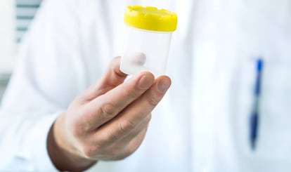 Un sanitario sosteniendo una taza de muestra de orina.