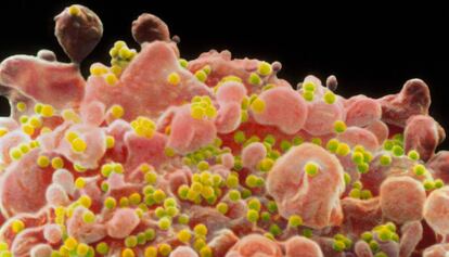 Imatge microscòpica del virus del VIH.