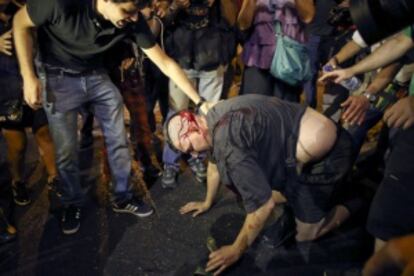 Un manifestante herido tras las cargas.