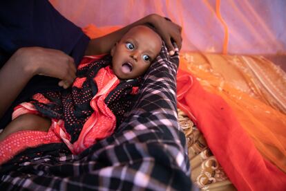 Unos 126.000 niños y niñas etíopes sufren desnutrición grave, y se estima que ese número aumentará debido a que probablemente se perderán más cosechas. Se calcula que 3,4 millones de etíopes requerirán ayuda alimentaria en los próximos tres meses y que seis millones de niños y niñas corren peligro de desnutrición.