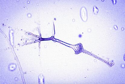 Saksenaea vasiformis: este ubicuo hongo del suelo rara vez se ve en el laboratorio de microbiología, pero deleita al ojo cuando se lo encuentra con sus esporangios característicos en forma de matraz.

 
