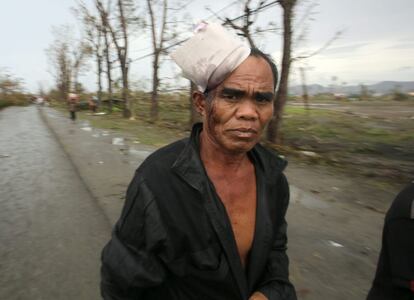 Un filipino herido por el tifón durante la tormenta.