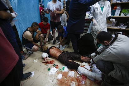Palestinians injured in an Israeli airstrike on a school for displaced people in the Nuseirat refugee camp are taken to Al Aqsa Martyrs Hospital.