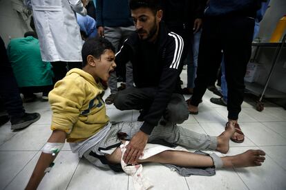 Un niño herido en un bombardeo israelí sobre una escuela gestionada por la ONU recibe tratamiento médico en el hospital Nasser en Jan Yunis, este domingo. 