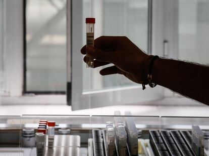 Un técnico de laboratorio sostiene una muestra antes de hacer la PCR.